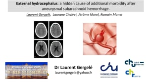 External hydrocephalus: a hidden cause of additional morbidity after aneurysmal subarachnoid hemorrhage-Laurent Gergele