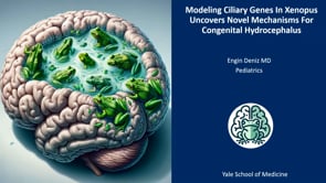 Modeling Ciliary Genes in Xenopus Uncovers Novel Mechanisms for Congenital Hydrocephalus-Engin Deniz
