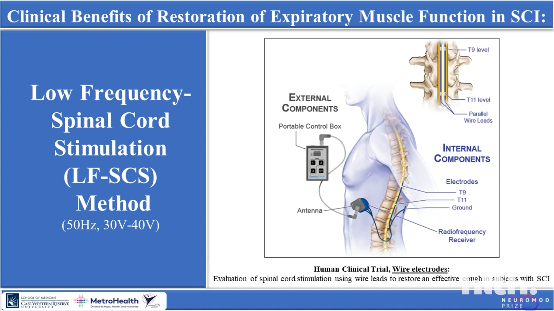 Neuromod Prize Finalist Showcase