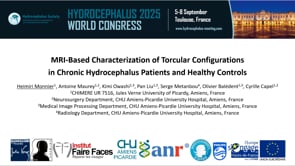 MRI-Based Characterization of Torcular Configurations in Chronic Hydrocephalus Patients and Healthy Controls-Heimiri Monnier