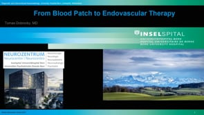 From Blood Patch to Endovascular Therapy-Tomas Dobrocky