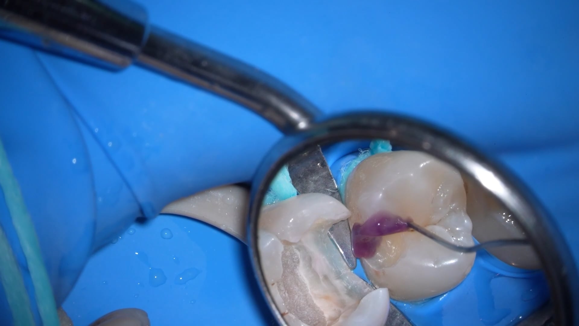 【GPB_direct-bonding_lup_030】前処理