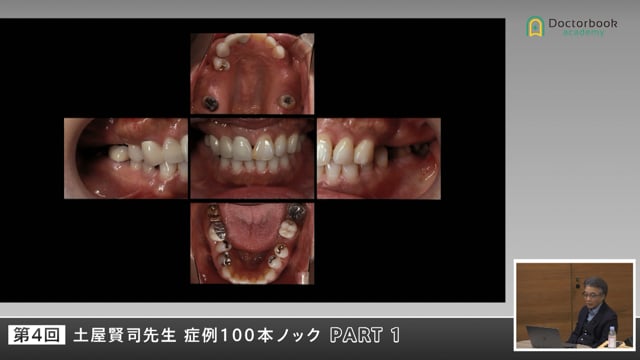 パノラマ1枚から患者を“診る”力―包括的治療の実践 #1