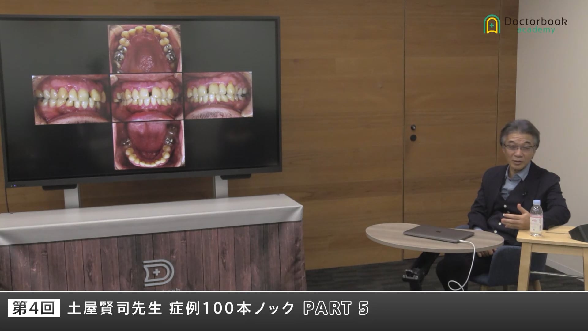 “見落としやすい咬合と補綴の落とし穴”を読み解く #5