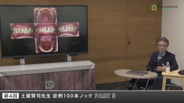 “見落としやすい咬合と補綴の落とし穴”を読み解く #5