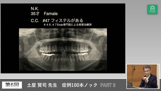 トラブル症例と無自覚患者へ診断力と伝える力 #3