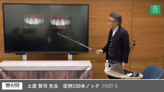 顔貌と調和する前歯部審美を考える #5