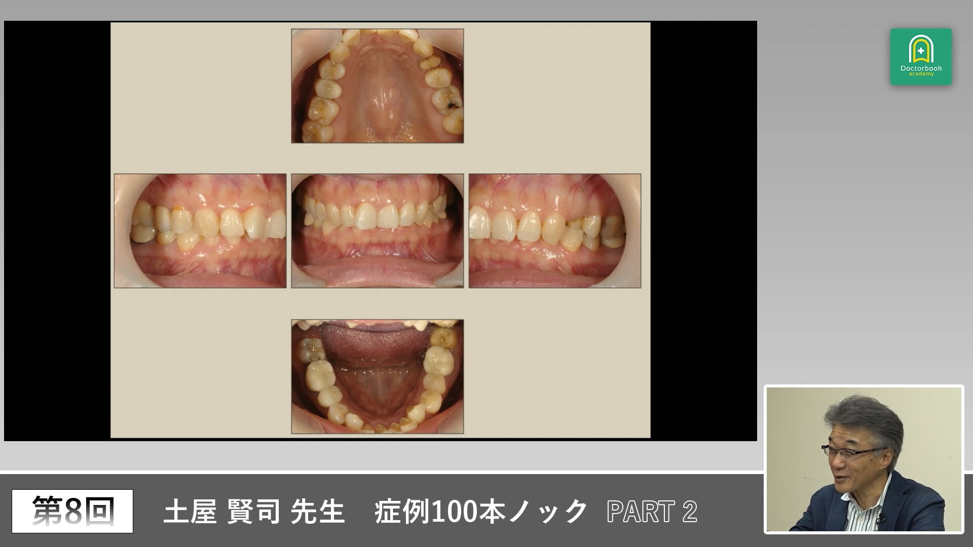 痛みをきっかけに患者の経過と背景を探る症例 #2