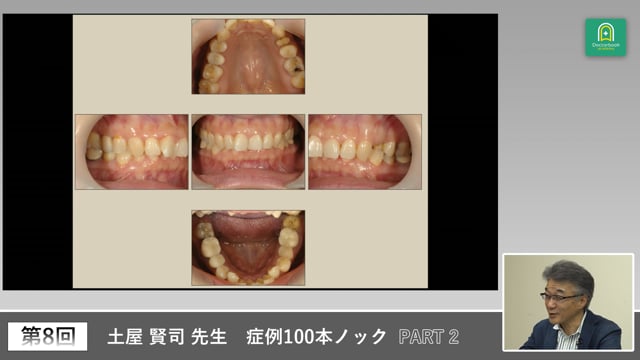 痛みをきっかけに患者の経過と背景を探る症例 #2
