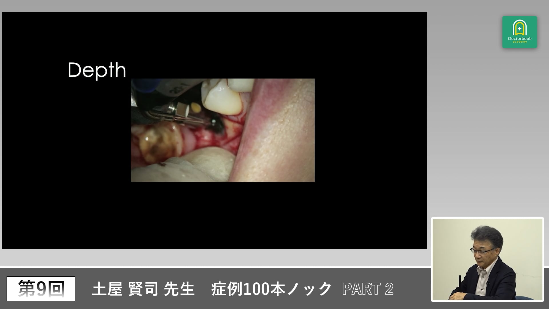 インプラント治療の変遷と埋入深度を考える臨床講義 #2