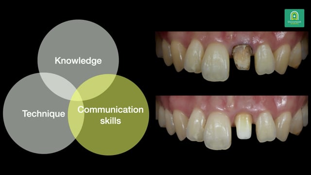 咬合再構成の症例プレゼンとコンサルテーションの実践 #3