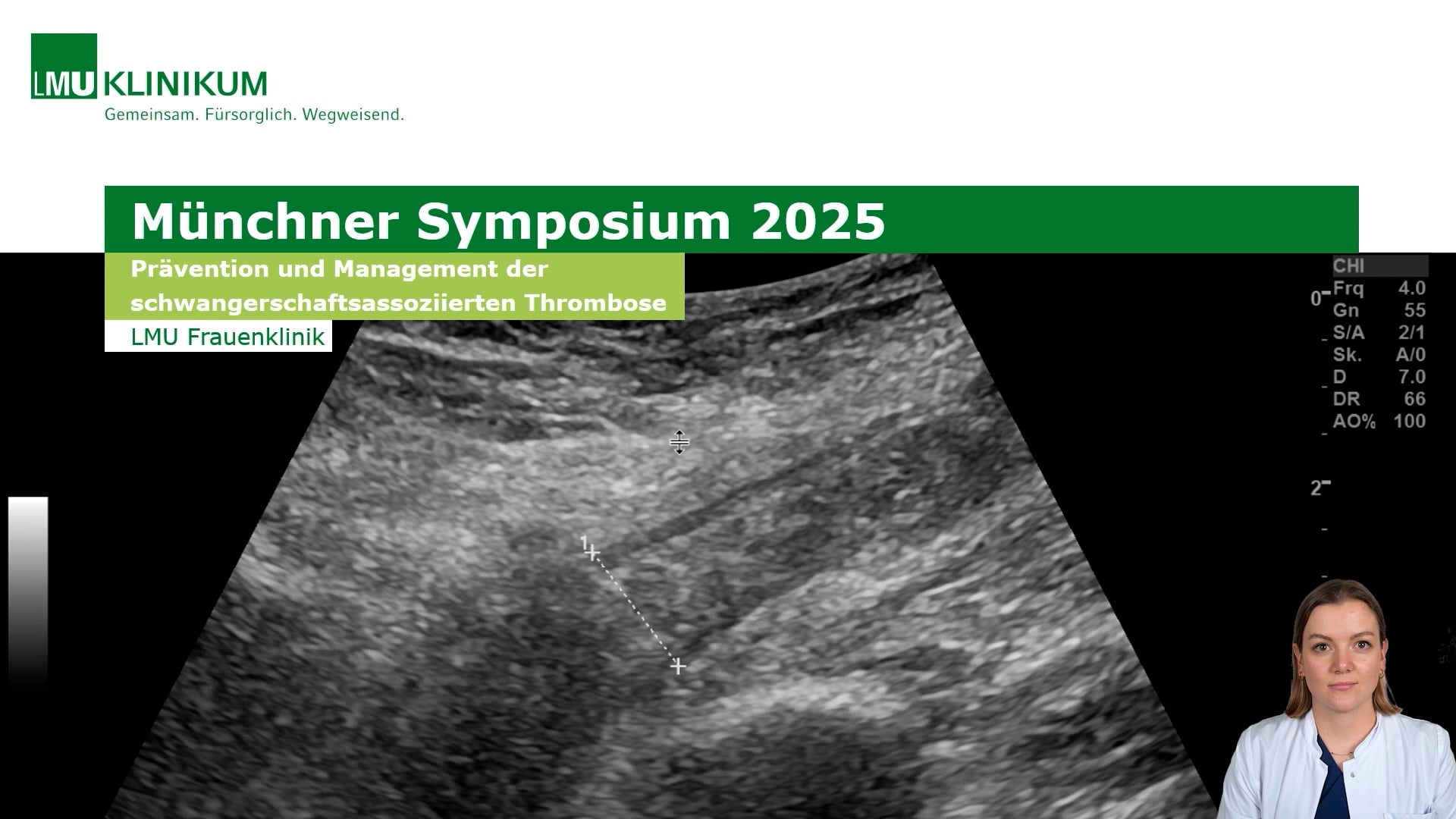 Thumbnail von Prävention und Management der schwangerschaftsassoziierten Thrombose