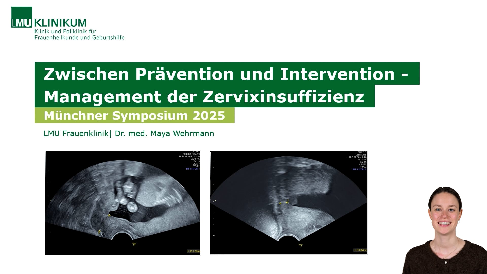Thumbnail von Zwischen Prävention und Intervention – Management der Zervixinsuffizienz 