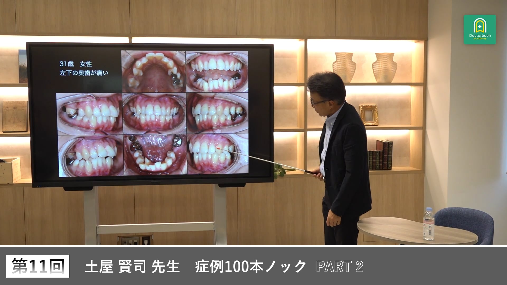 咬合診査の重要性を考える左下7クラウン症例ディスカッション #2