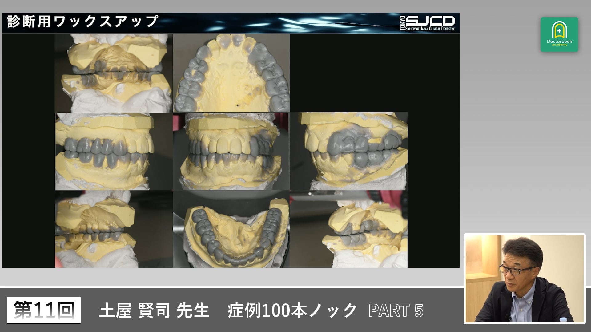 中切歯の位置関係と歯軸を見極める補綴診断 #5