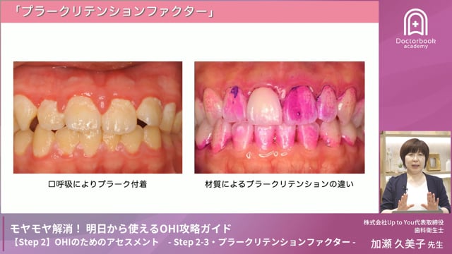 Step 2-3　プラークリテンションファクター