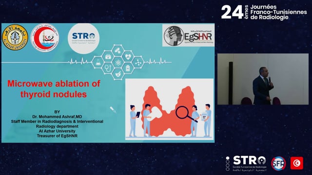 Percutaneous thermoablation of thyroid nodules
