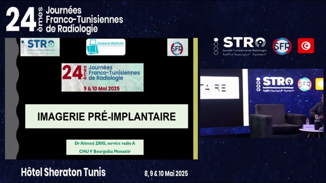 Imagerie pré-implant