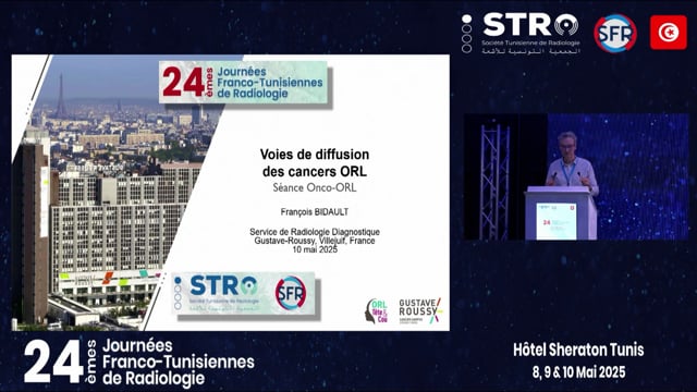 Voies de diffusion des cancers ORL