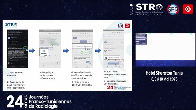 Coroscanner : apport et indications