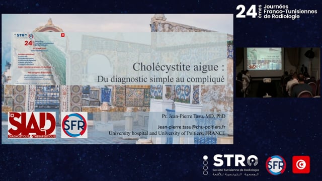 La Cholécystite : de la forme simple aux diagnostics difficiles