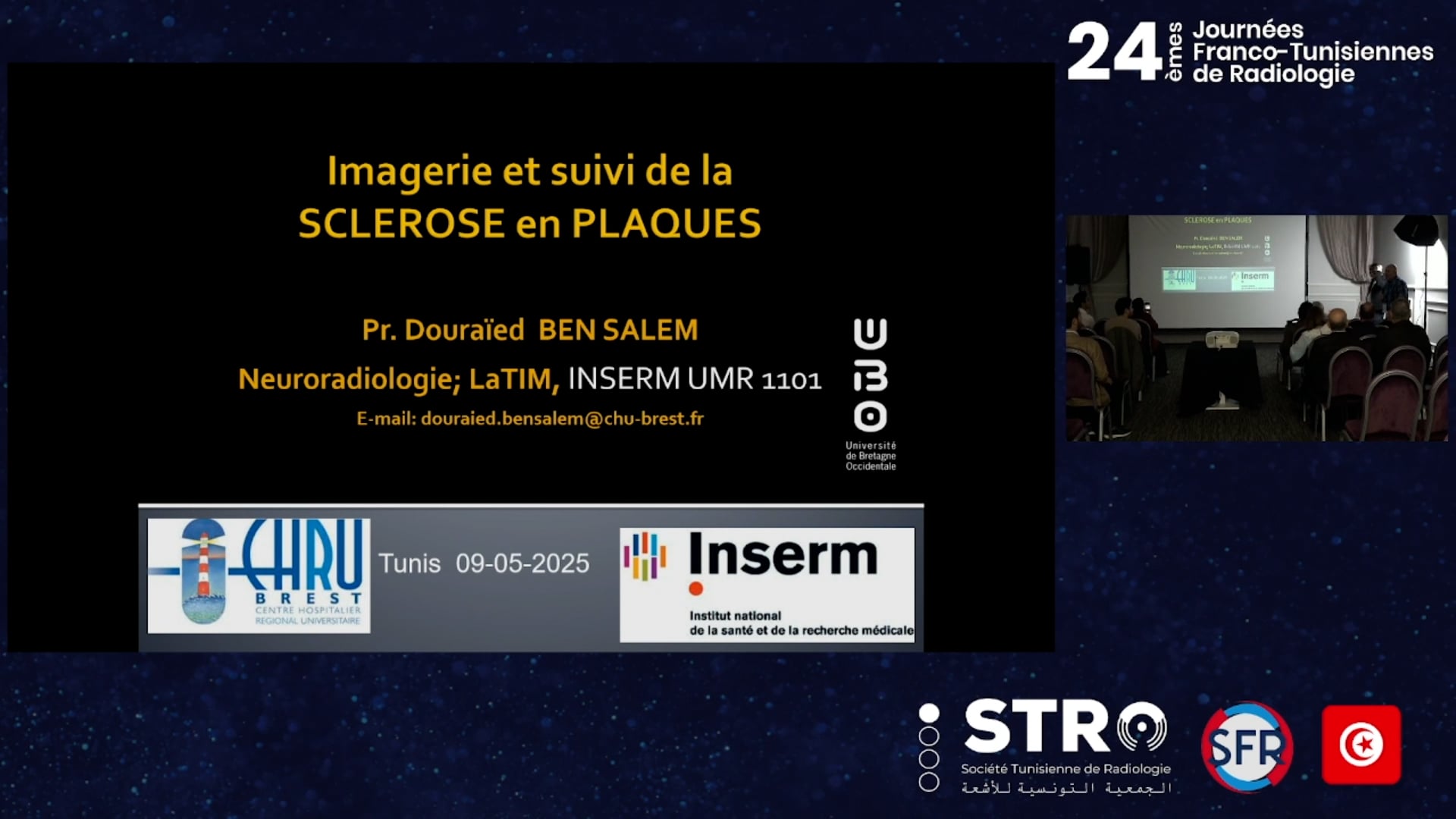 Nouveaux critères en imagerie de SEP 2024 de McDonald’s