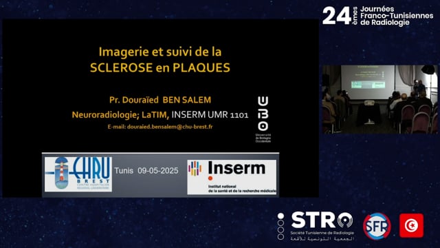 Nouveaux critères en imagerie de SEP 2024 de McDonald’s