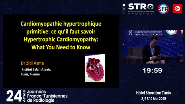 Cardiomyopathie hypertrophique primitive : ce qu’il faut savoir