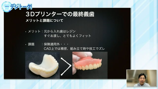 3Dプリンターを用いた様々な義歯の作製方法