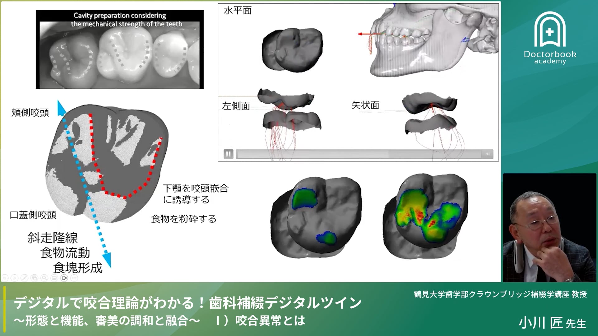 デジタルで咬合理論がわかる！歯科補綴デジタルツイン『咬合異常とは』