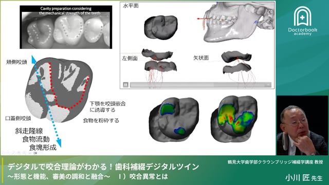 デジタルで咬合理論がわかる！歯科補綴デジタルツイン『咬合異常とは』