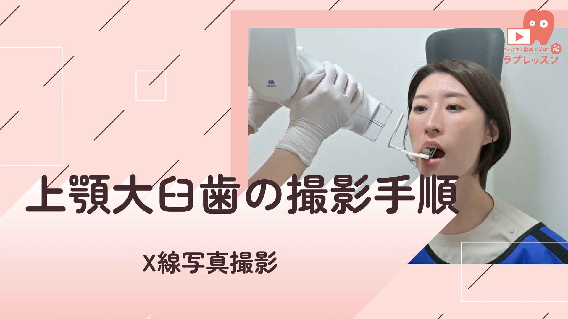 02.上顎大臼歯の撮影手順