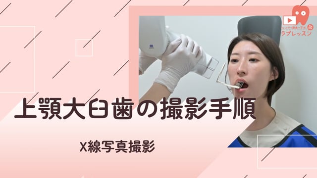 02.上顎大臼歯の撮影手順