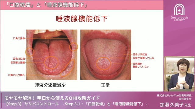 Step 3-1　「口腔乾燥」と「唾液腺機能低下」