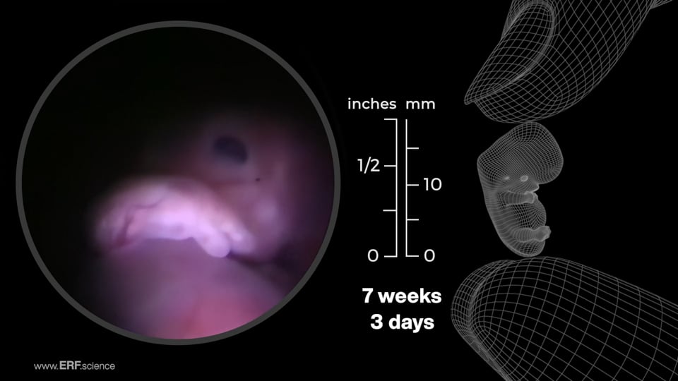 Fetal Development through all stages of pregnancy