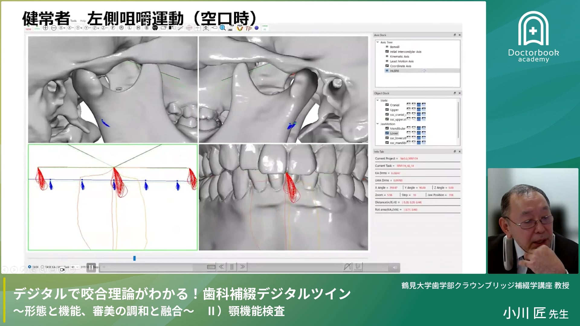 デジタルで咬合理論がわかる！歯科補綴デジタルツイン『顎機能検査』　後編