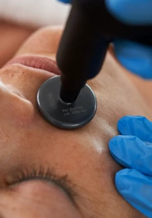 INDIBA キャパエレクトロード30mm(溝あり) INDIBA キャパエレクトロード30mm(溝あり) 2025年最新】インディバ