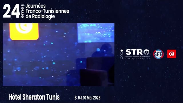 TDM de perfusion cérébrale: Les algorithmes & acquisition