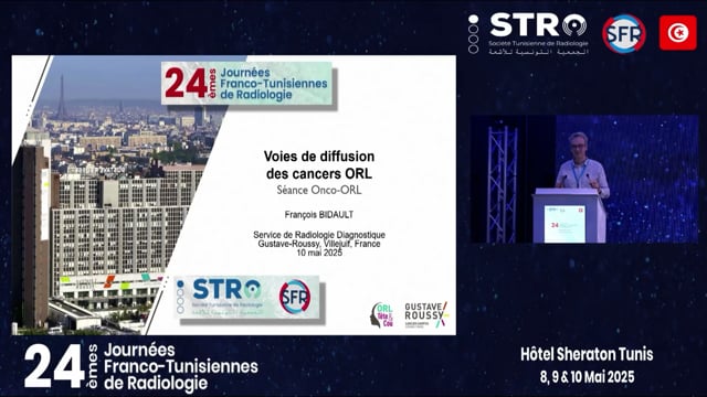 Voies de diffusion des cancers ORL