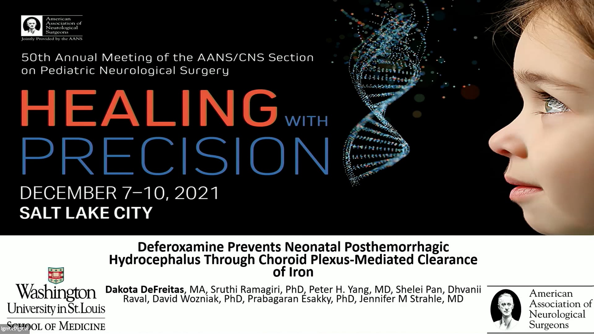 Deferoxamine Prevents Neonatal Posthemorrhagic Hydrocephalus Through Choroid Plexus – Mediated Clearance of Iron