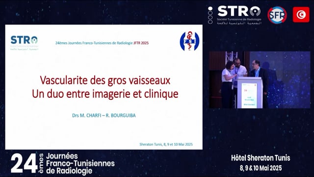 Vascularite des gros vaisseaux : un duo entre imagerie et clinique