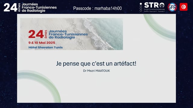 Atelier IRM : Je pense que c'est un artéfact!