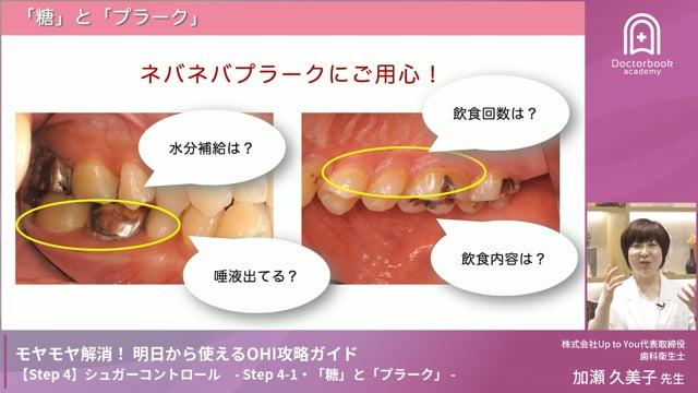Step 4-1　「糖」と「プラーク」
