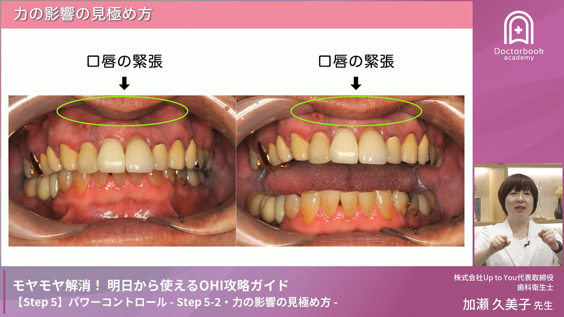 Step 5-2　力の影響の見極め方