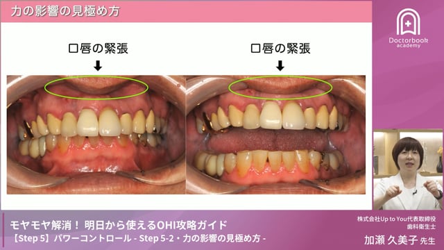 Step 5-2　力の影響の見極め方
