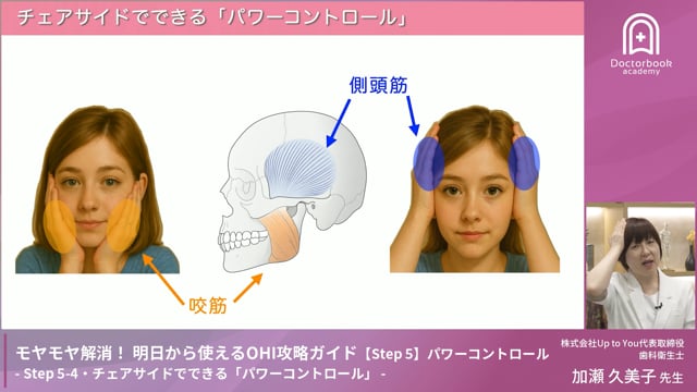 Step 5-4　チェアサイドでできる「パワーコントロール」