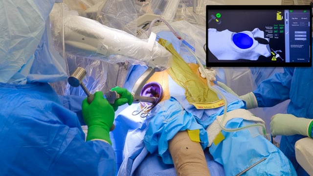 Anterior Robotic Total Hip Arthroplasty for Legg-Calve-Perthes Disease