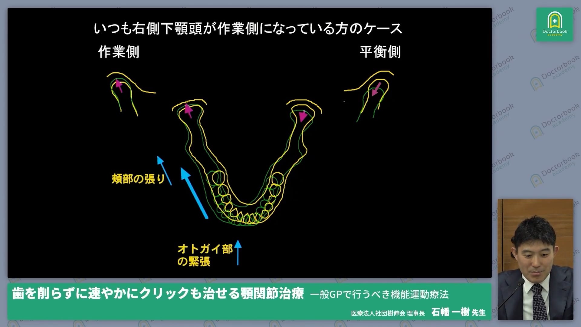  臨床知見録_顎関節の解剖学的知識_片側咀嚼が及ぼす関節負荷の解析