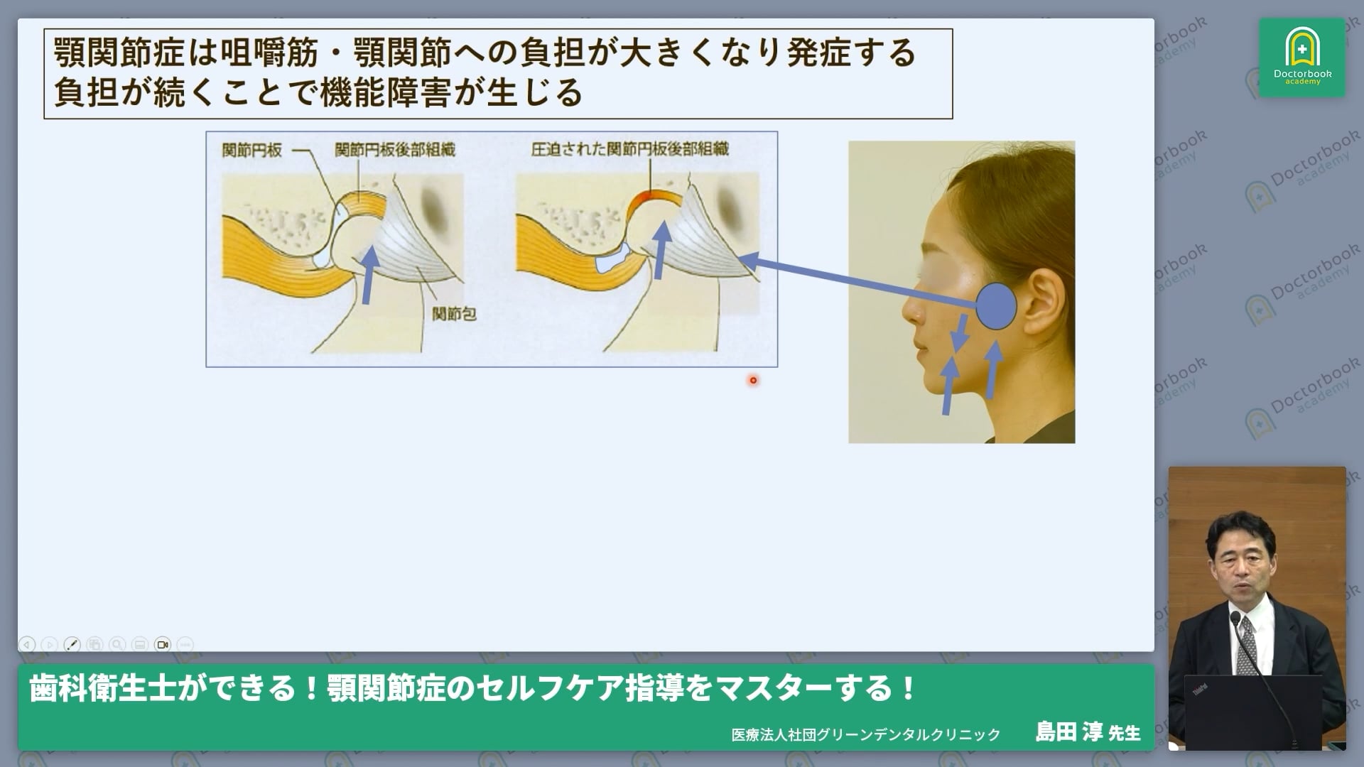  臨床知見録_顎関節の解剖学的知識_関節円板前方転位の動態評価