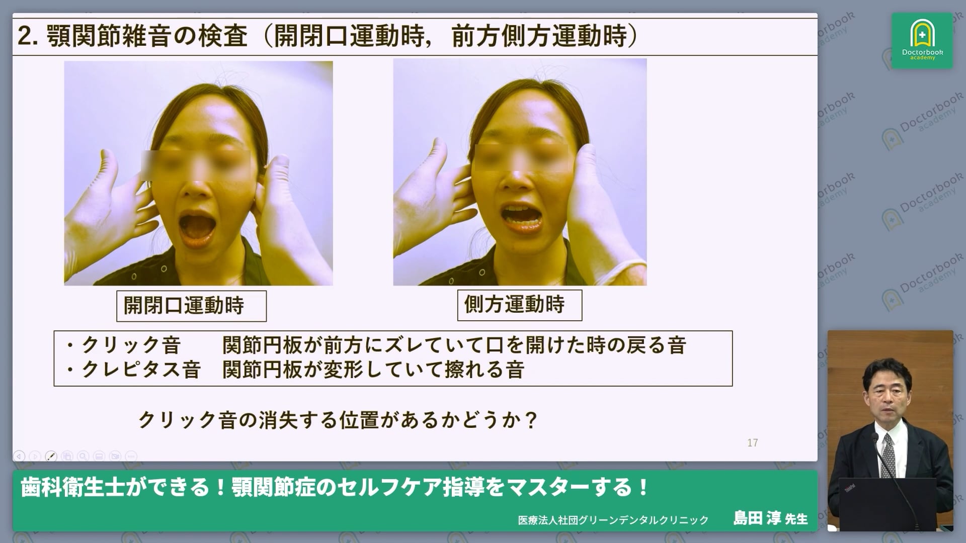  臨床知見録_検査方法_顎関節雑音から読み解く病態評価